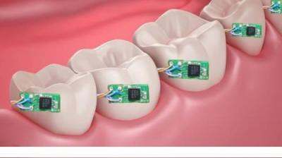  دندان مصنوعی بلوتوث دار تکنولوژی جدید
