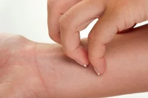 در حساسیت های پوستی چه بخوریم و چه نخوریم؟