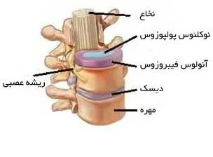دیسک بین مهره ها چیست؟