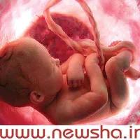 تاثیر نویز بر سیستم شنوایی جنین