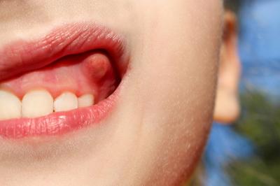  معرفی قرص برای عفونت دندان