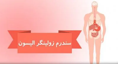 سندرم زولینگر – الیسون