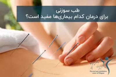 طب سوزنی برای درمان کدام بیماری‌ها مفید است؟