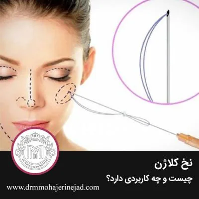 نخ کلاژن چیست و چه کاربردی دارد؟