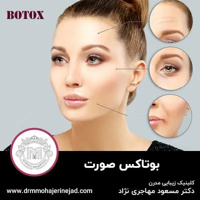 هرآنچه باید از بوتاکس صورت بدانید