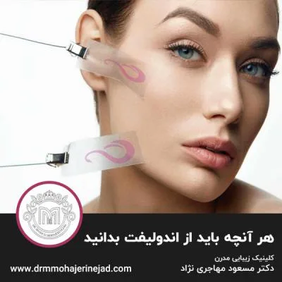 هر آنچه باید از اندولیفت بدانید