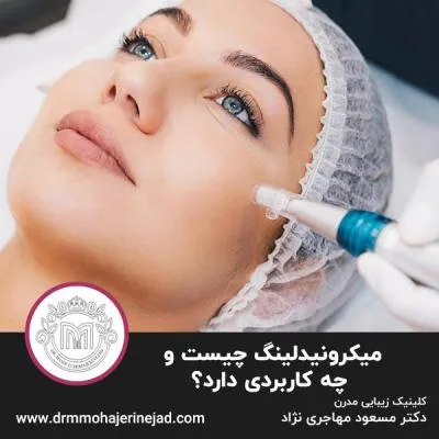 میکرونیدلینگ چیست و چه کاربردی دارد؟