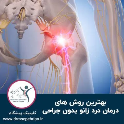 بهترین روش های درمان سیاتیک بدون جراحی