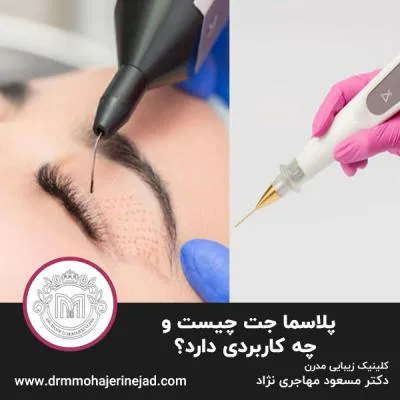 پلاسما جت چیست و چه کاربردی دارد؟