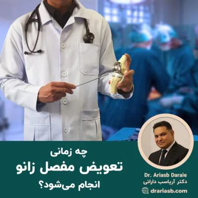 چه زمانی تعویض مفصل زانو انجام می شود؟