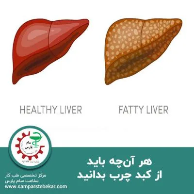 هر آن‌چه باید از کبد چرب بدانید
