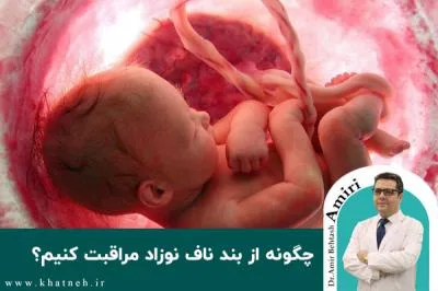 چگونه از بند ناف نوزاد مراقبت کنیم؟
