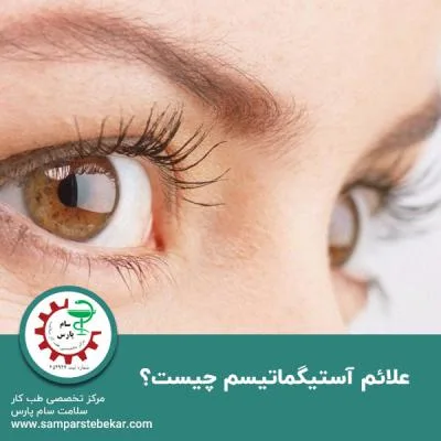 علائم آستیگماتیسم چیست؟