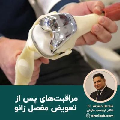 مراقبت های پس از تعویض مفصل زانو