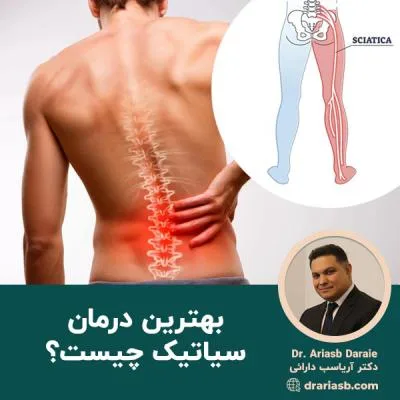بهترین درمان سیاتیک چیست؟