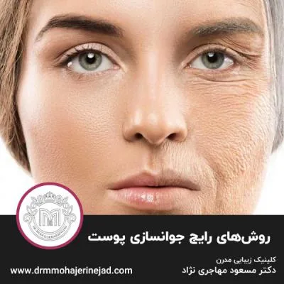 روش‌های رایج جوانسازی پوست