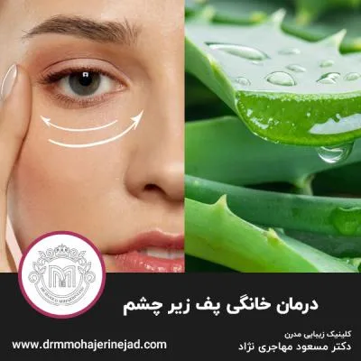 درمان خانگی پف زیر چشم