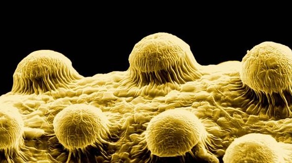 electron-microscope-592x330