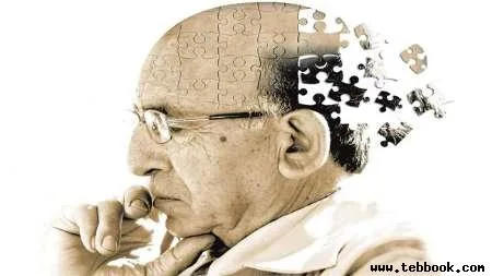 تصویر کاور بیماری آلزایمر (Alzheimer's disease)