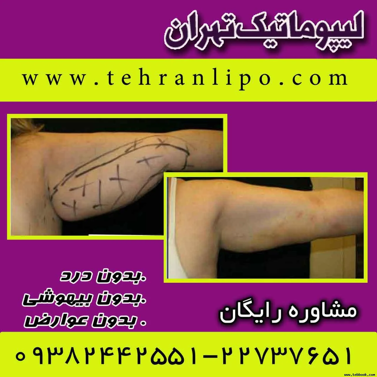 تصویر کاور لیپوماتیک