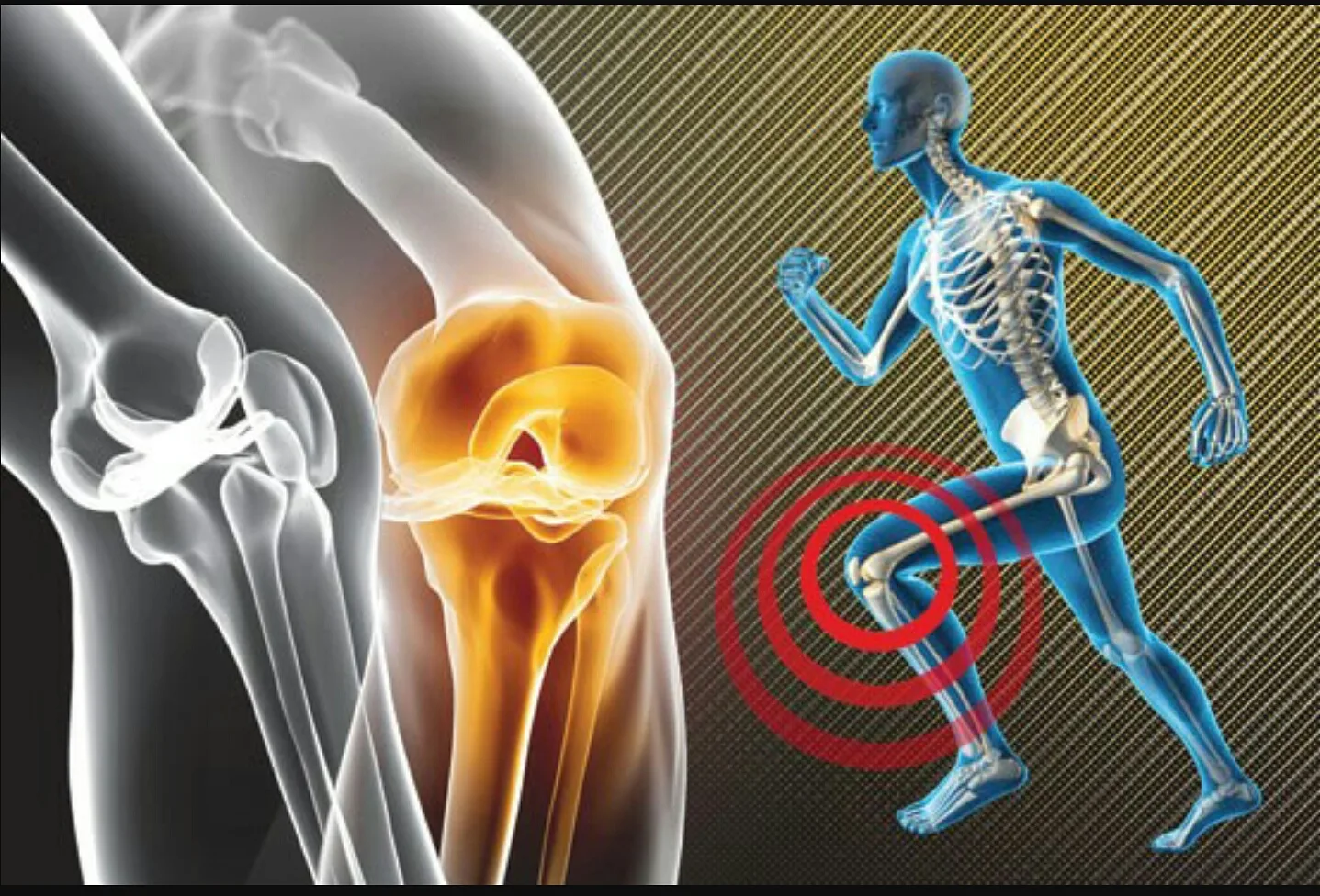 تصویر کاور دکتر آقایی افشار متخصص آسیب ورزشی (sports medicine) درد و مشکلات عضلانی اسکلتی و مفاصل