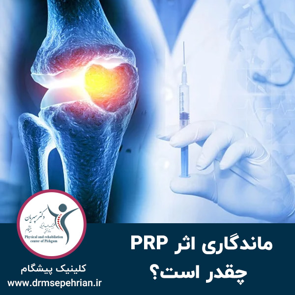  ماندگاری اثر PRP چقدر است؟