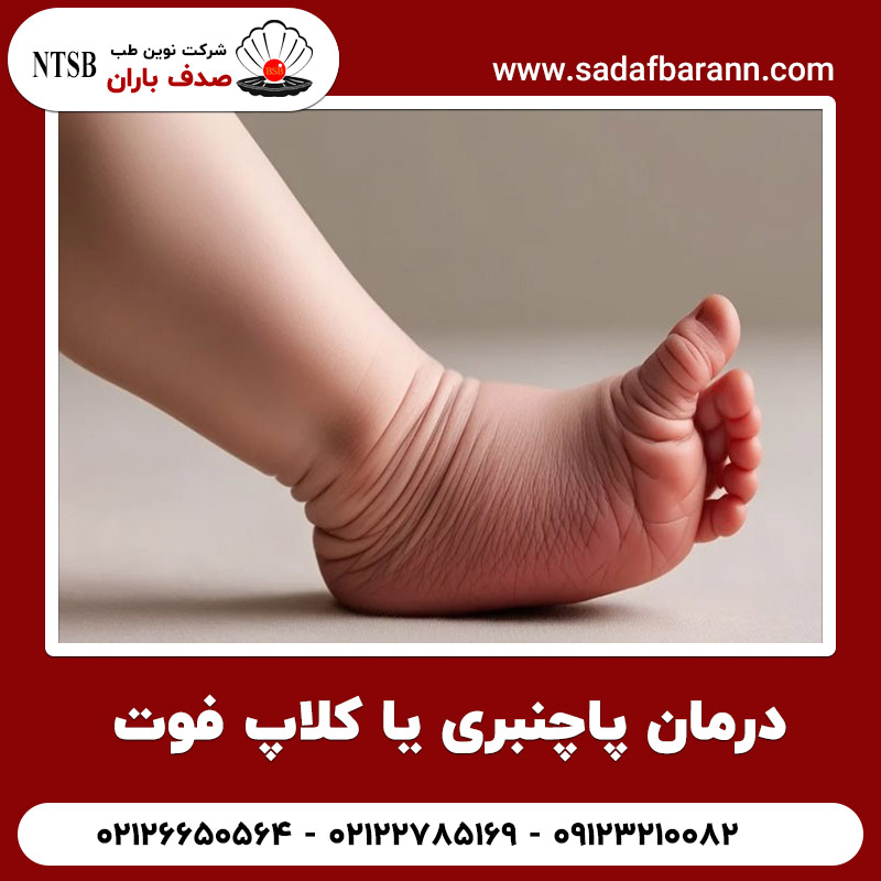  درمان پاچنبری یا کلاپ فوت