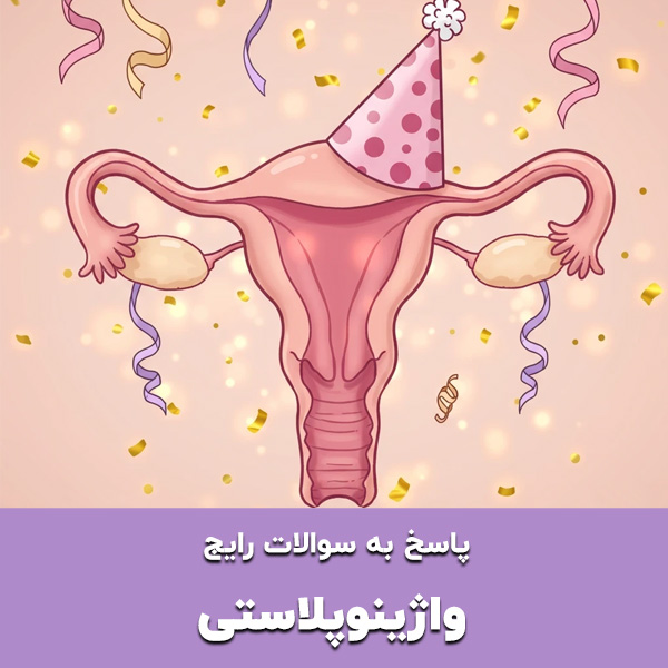  پاسخ به سوالات رایج در مورد واژینوپلاستی