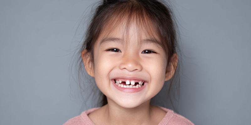  علت خرد شدن دندان شیری کودکان چیست؟