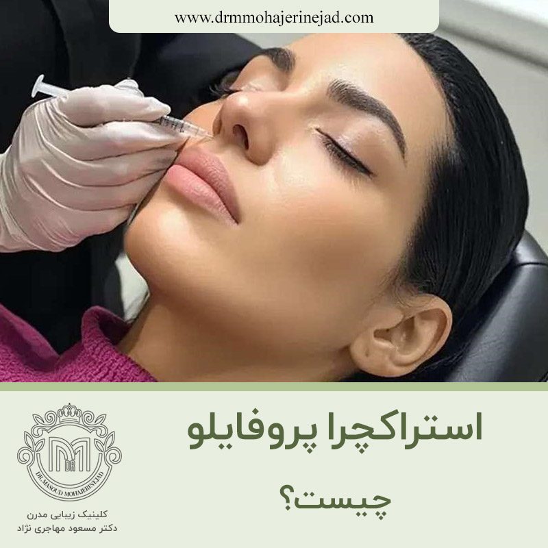  استراکچرا پروفایلو چیست؟