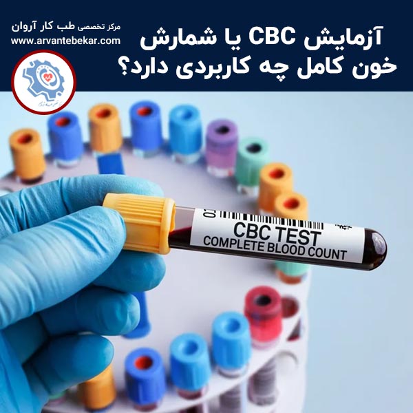  آزمایش CBC یا شمارش خون کامل چه کاربردی دارد؟