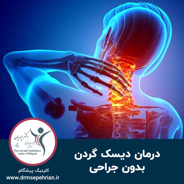  درمان دیسک گردن بدون جراحی