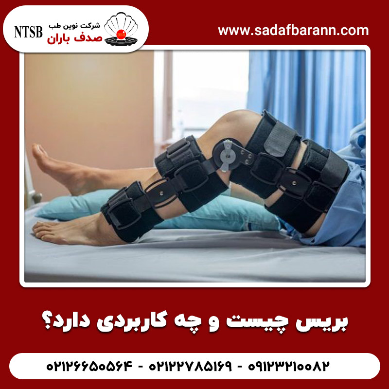  بریس چیست و چه کاربردی دارد؟