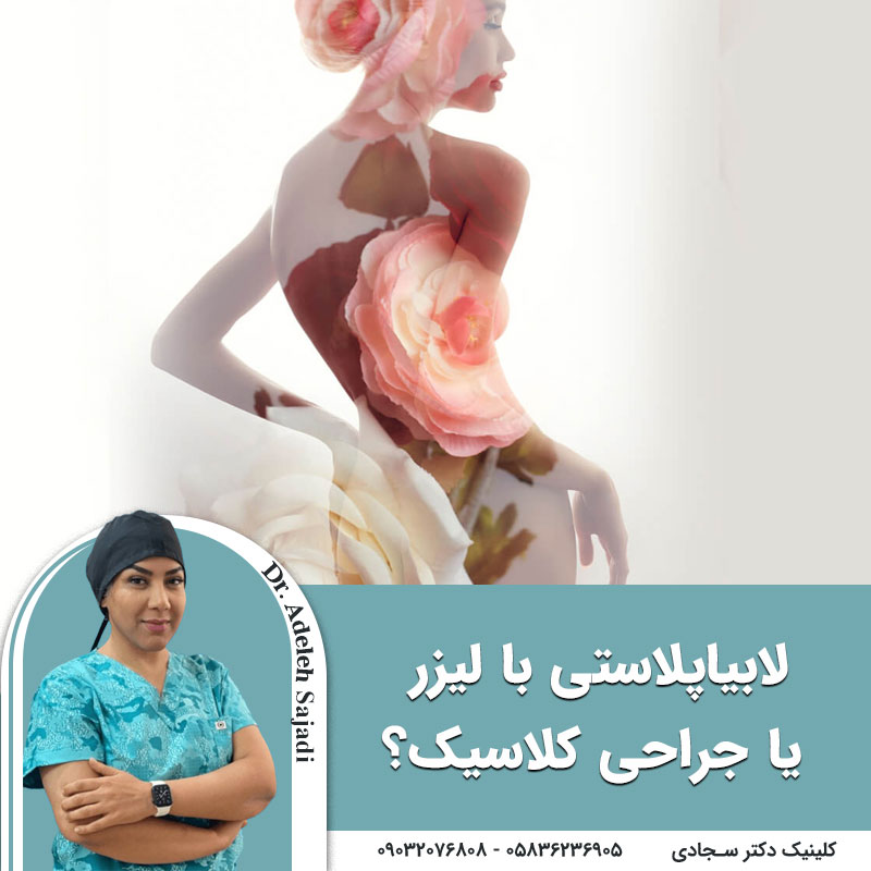  لابیاپلاستی با لیزر یا جراحی کلاسیک؟