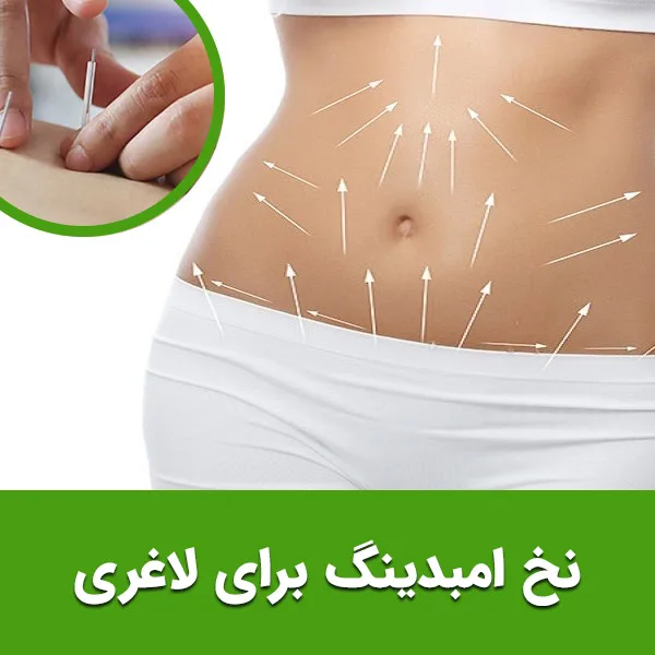 نخ امبدینگ برای لاغری