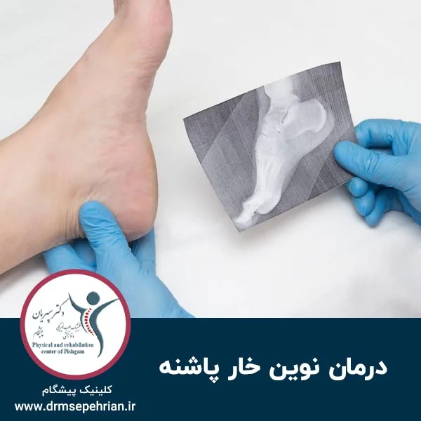 درمان نوین خار پاشنه