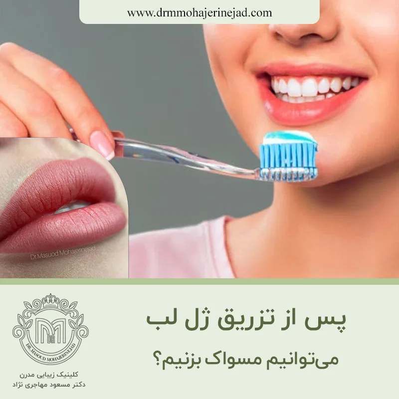 آیا پس از تزریق ژل لب می توانیم مسواک بزنیم؟
