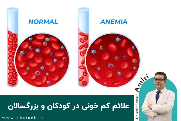 علائم کم خونی در کودکان و بزرگسالان چیست؟