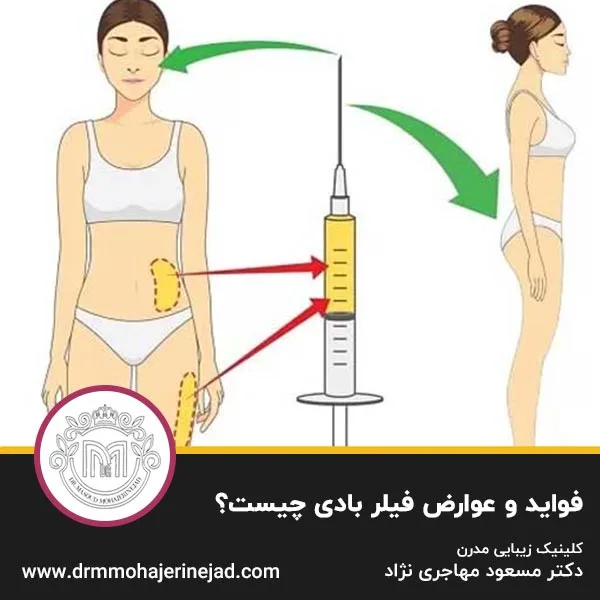 فواید و عوارض فیلر بادی چیست؟