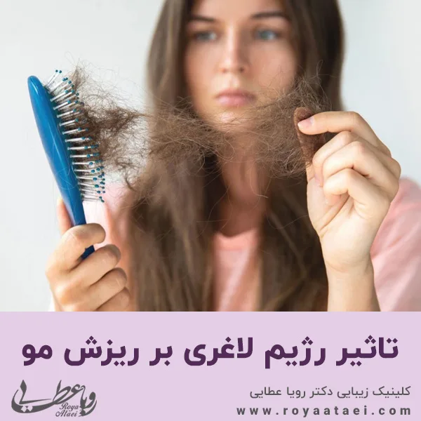 تاثیر رژیم لاغری بر ریزش مو