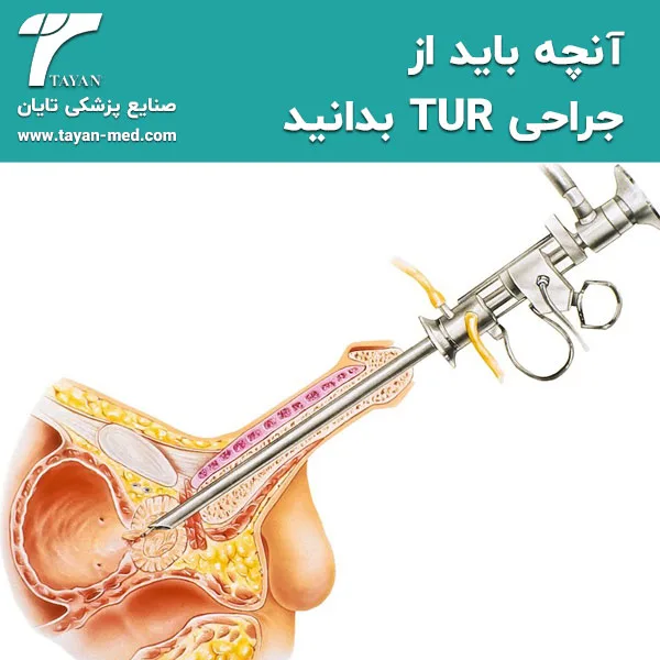 آنچه باید از جراحی TUR بدانید