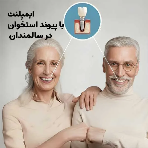 ایمپلنت و کاشت دندان با وجود پوکی استخوان در سنین بالا