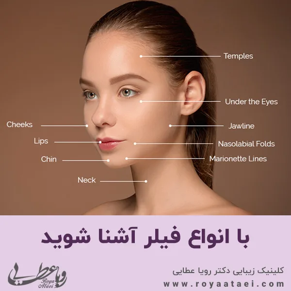 با انواع فیلر آشنا شوید