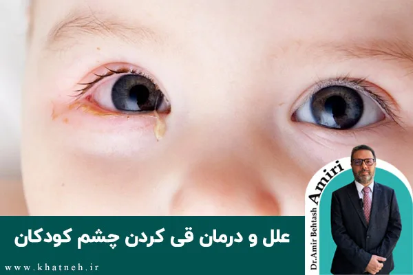علل و درمان قی کردن چشم کودکان