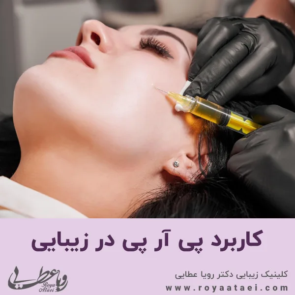 کاربرد پی آر پی در زیبایی 