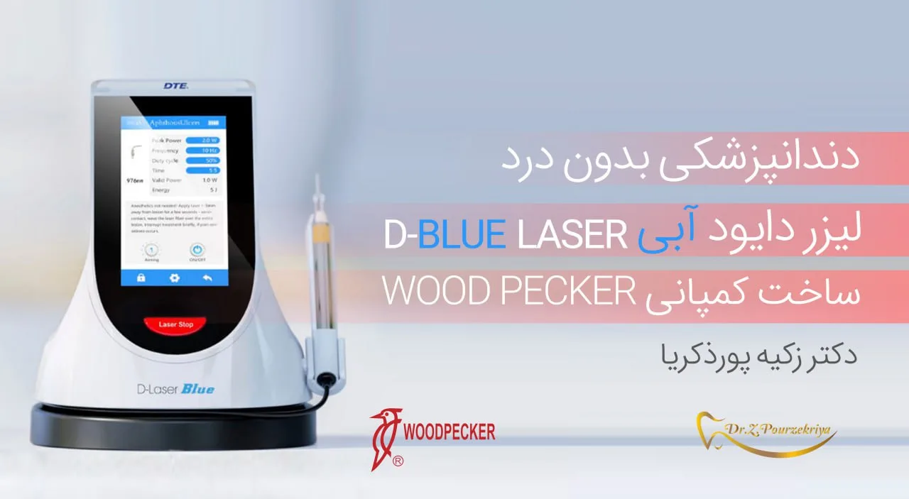 دندانپزشکی بدون درد با لیزر دایود آبی