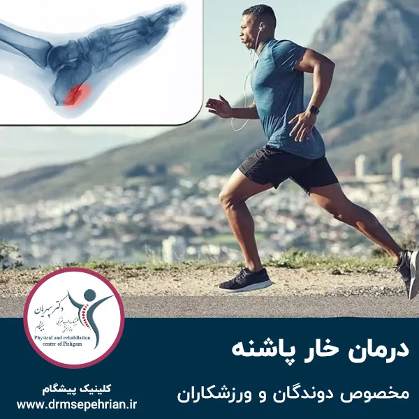 درمان خار پاشنه مخصوص دوندگان و ورزشکاران