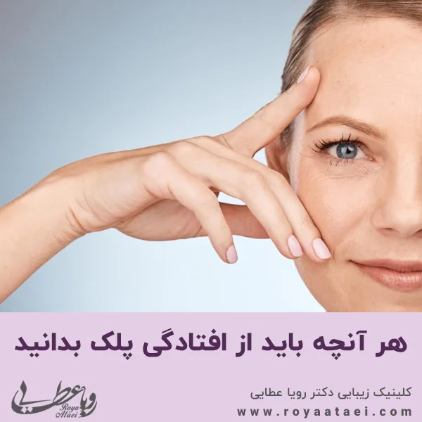 هر آنچه باید از افتادگی پلک بدانید