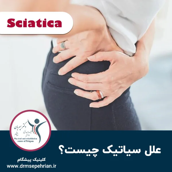 علل سیاتیک چیست؟