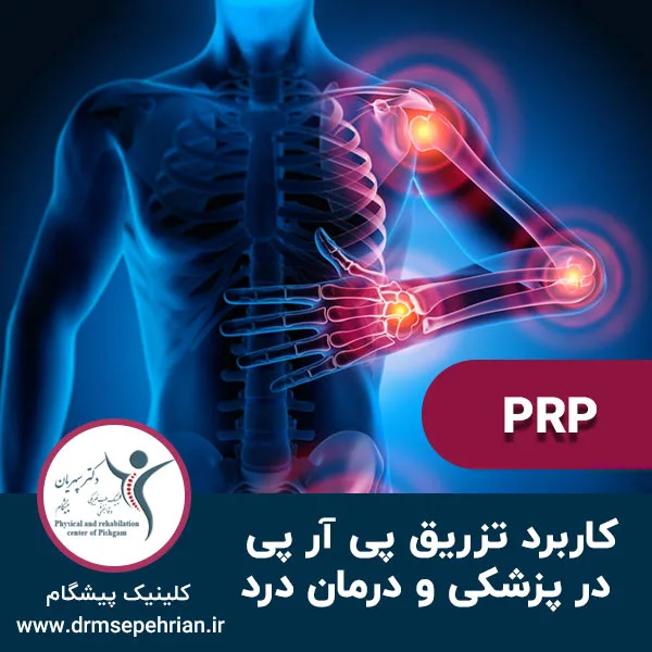 کاربرد تزریق پی آر پی در پزشکی و درمان درد